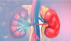 رنگ ادرارتان خبر از بیماریتان می دهد! | با دیدن این نشانه ها به وجود سرطان کلیه مشکوک شوید 