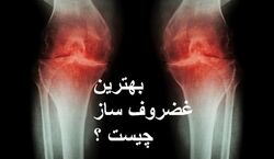 به جای قرص های شیمیایی، غضروف ساز های طبیعی بخورید!