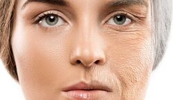 ماسک ضد چروک خانگی | جوانسازی و شادابی پوست با روش های ساده