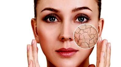 درمان خشکی پوست با راهکارهای ساده + علل و پیشگیری