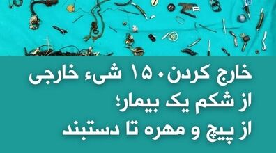 کشف ۱۵۰ شی از شکم بیمار | از پیچ و مهره تا دستبند +عکس