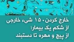 کشف ۱۵۰ شی از شکم بیمار | از پیچ و مهره تا دستبند +عکس