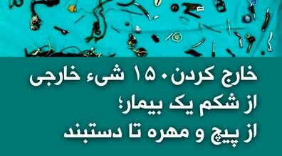 کشف ۱۵۰ شی از شکم بیمار | از پیچ و مهره تا دستبند +عکس