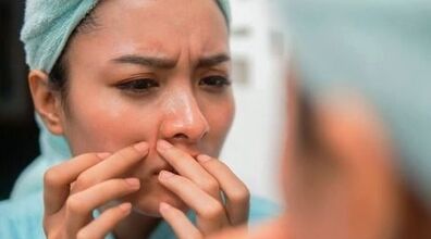 خوراکی هایی که باعث میشن پوستت جوش بزنه!