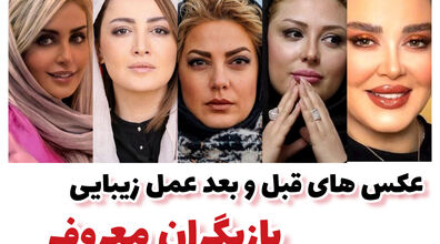 عکس های قبل و بعد عمل زیبایی 7 تا از بازیگران ایرانی | چی بودی چی شدی تو اینجا جوابه!!