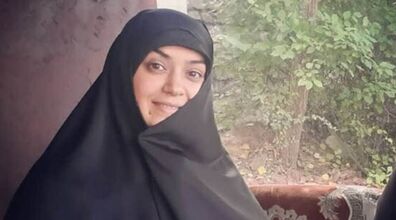 جراحی زیبایی الهام چرخنده خبرساز شد! | استوری جنجالی الهام چرخنده!