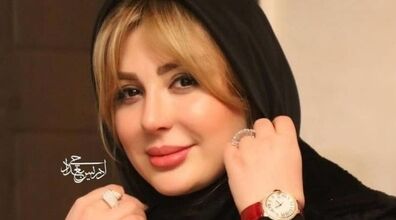 تغییر چهره نیوشا ضیغمی بعد از عمل زیبایی جدیدش شوکه تان می کند! + عکس