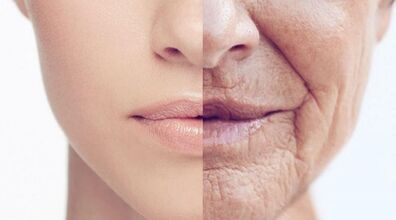 10 ماسک صورت خانگی برای رفع چین و چروک؛ از زیر هزینه های بوتاکس در برو!
